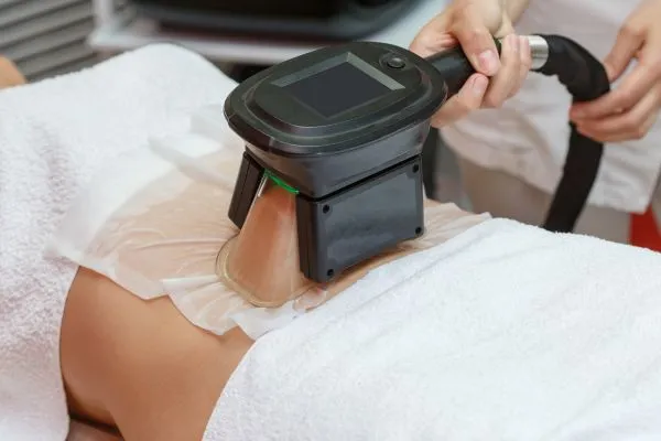 Image of person having fat freezing treatment to help weight gain South Yardley