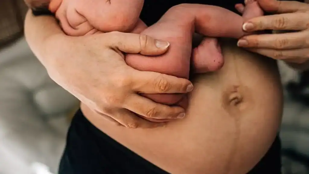 Why Is My Stomach Still Big After Pregnancy South Yardley?